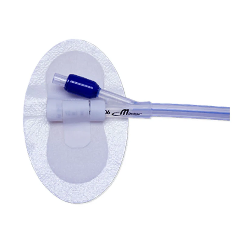 MDevices Catheter Securement Device (Sterile) | Carton of 50 - Image 3